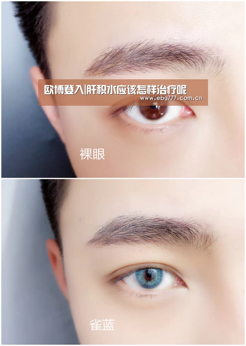 欧博登入|肝积水应该怎样治疗呢(图2) 欧博官方平台